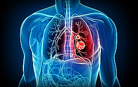Развитие и лечение бронхиальной астмы